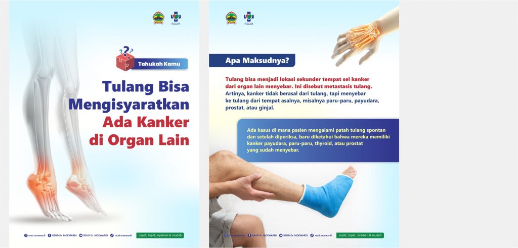 Tahukah Kamu? Tulang Bisa Mengisyaratkan Ada Kanker di Organ Lain